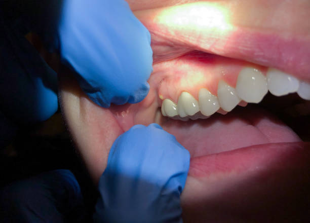 Best Broken or Cracked Tooth Emergency Dentist in Stockton, IL